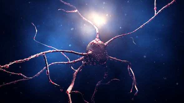 Reprogrammed Stem Cells Implanted into Patient with Parkinson's Disease