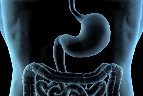 x-ray image of a stomach