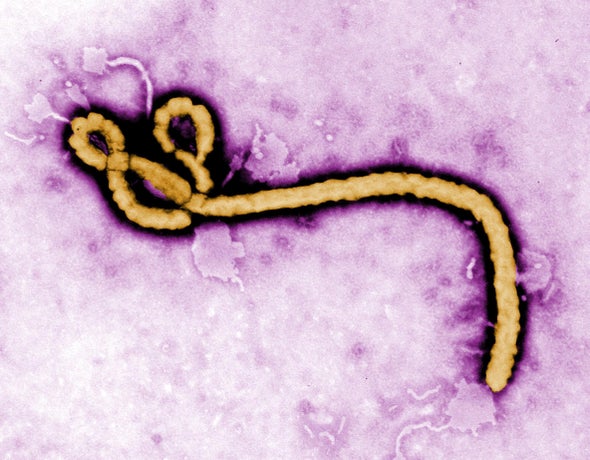 Ebola Virus Lingers Longer Than Scientists Thought