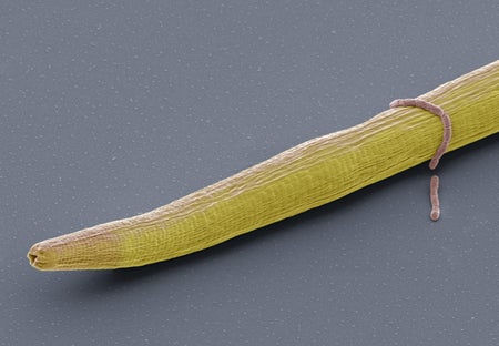 SEM of worm