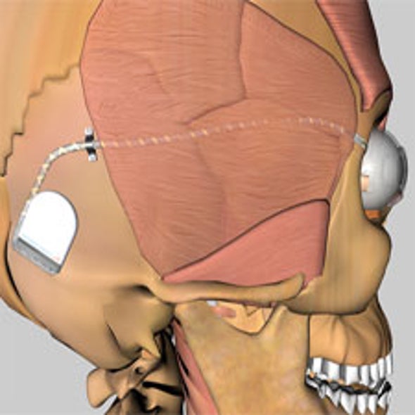 Vision Quest: Retinal Implants Deliver the Promise of Sight to Damaged Eyes