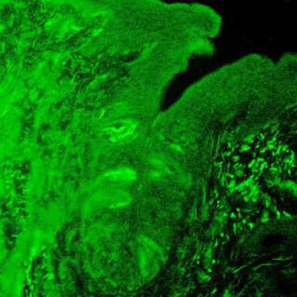 Like the Taste of Chalk? You're in Luck--Humans May Be Able to Taste Calcium
