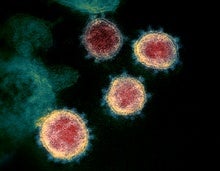Second Coronavirus Strain May Be More Infectious--but Some Scientists Are Skeptical