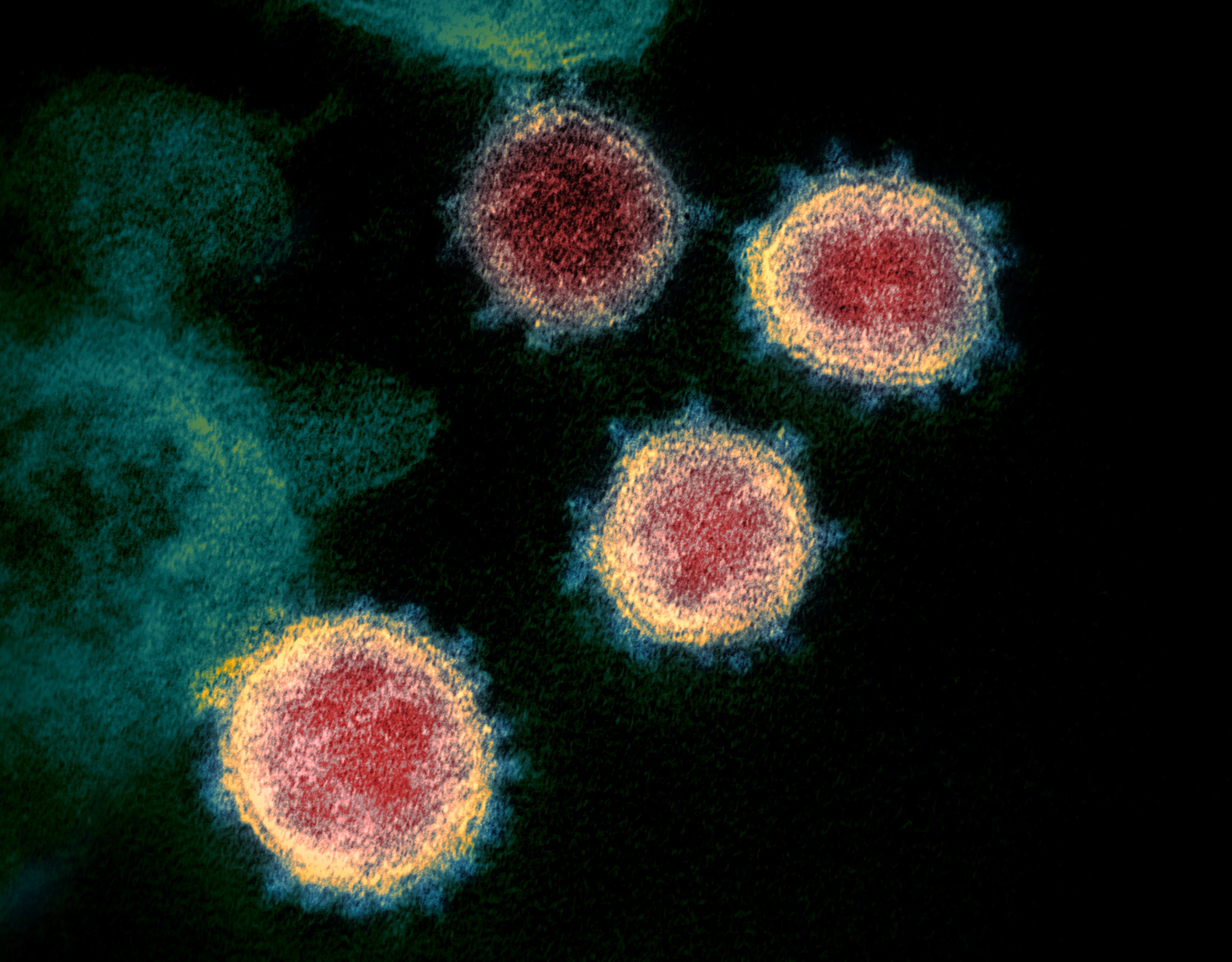 Second Coronavirus Strain May Be More Infectious--but Some Scientists Are  Skeptical - Scientific American