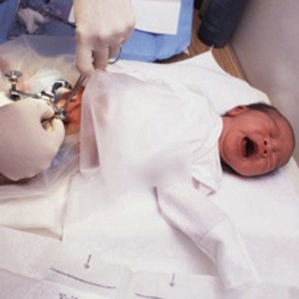 Clean-Cut: Study Finds Circumcision Helps Prevent HIV and Other Infections