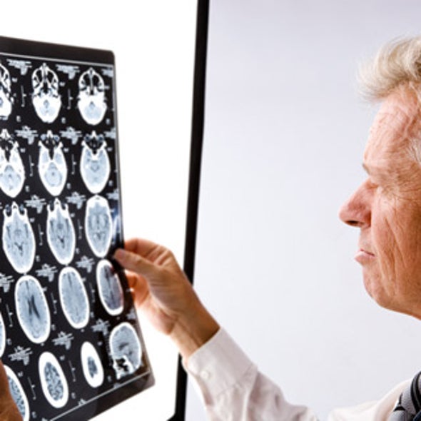 Legislation Introduced to Spur Treatments for Brain Ailments