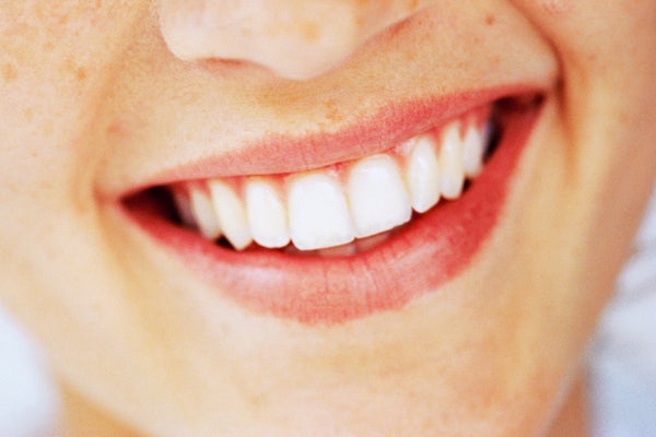 A closeup of a woman's teeth.