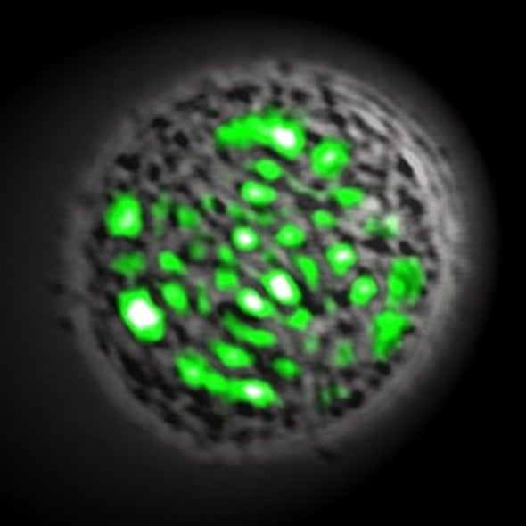 Green Fluorescent Protein Makes for Living Lasers