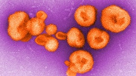 How to Stop the Next Outbreak from Becoming a Pandemic
