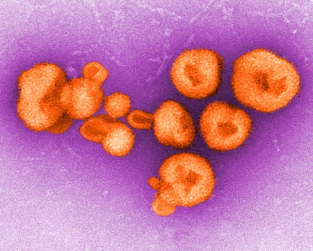 Lassa Virus, TEM, orange on pink background.