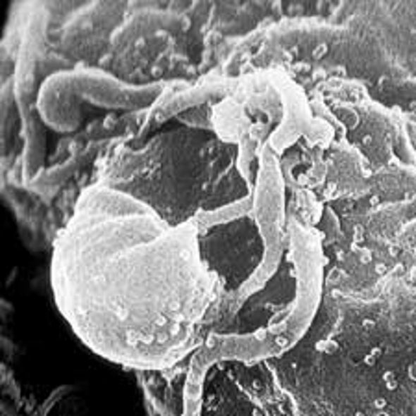 Three Distinct Routes Detailed for How HIV Arises in Male Genital Tract