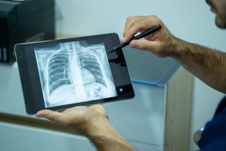 Doctor explaining the results of scan lung on digital tablet screen to patient