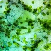 Chloroplasts, Kalanchoe millottii (Kalanchoe)