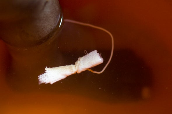 Stubborn Guinea Worm in Last-Gasp Fight against Eradication