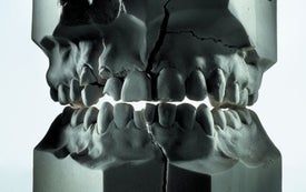 Why We Have So Many Problems with Our Teeth