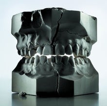 Why We Have So Many Problems with Our Teeth