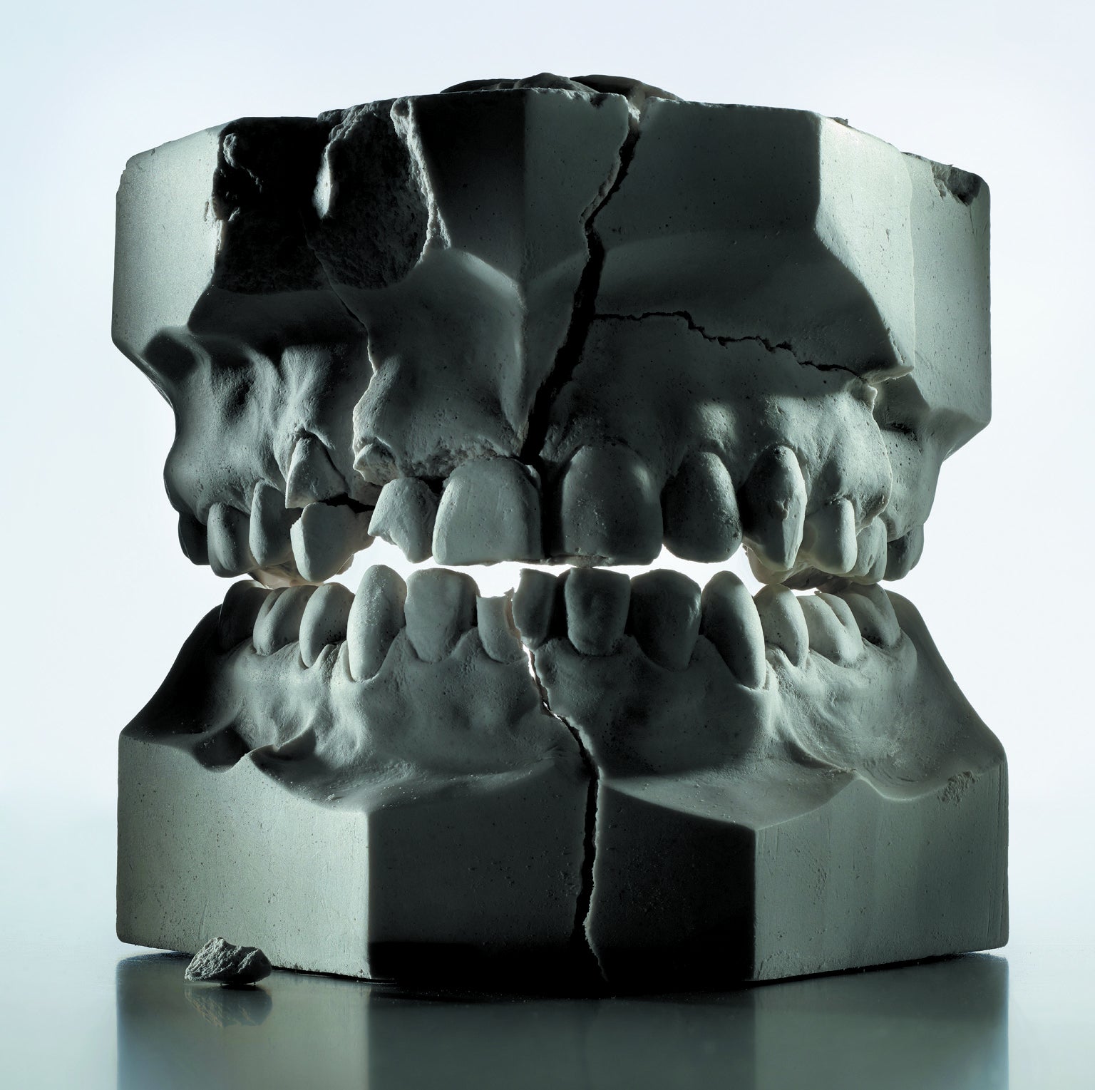 Why We Have So Many Problems with Our Teeth - Scientific American