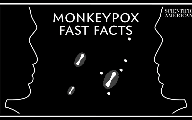 What We Know About Monkeypox 