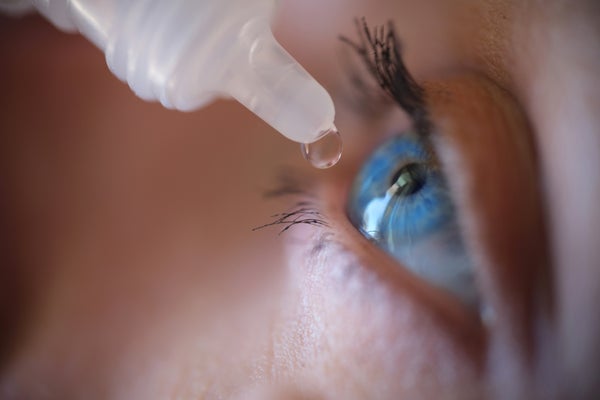 Woman applying eye drops to eye