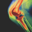 Saving Troubled Knees