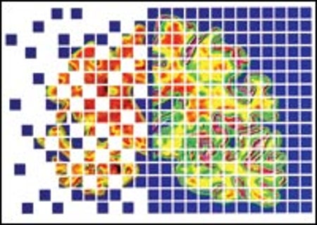 Prediction of tissue loss