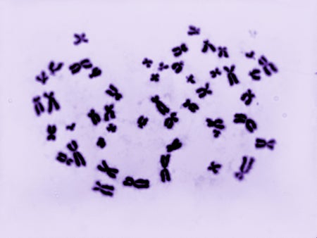 Human karyotype