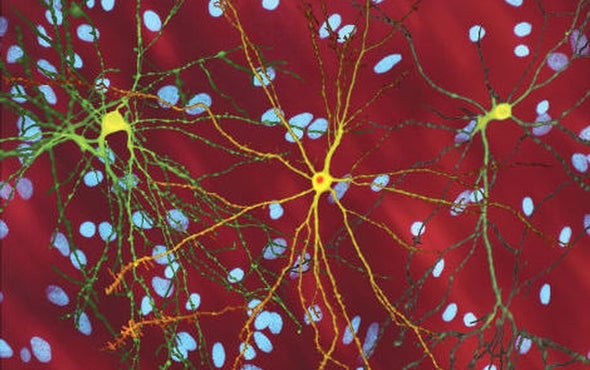 Research Using Brains-in-a-Dish Forces a Radical Rethinking of Huntington's Disease