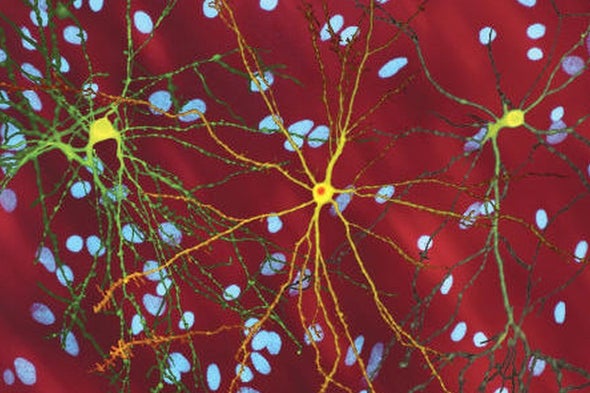 Research Using Brains-in-a-Dish Forces a Radical Rethinking of Huntington's Disease