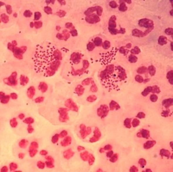 new treatment for gonorrhea prevents reinfection scientific american
