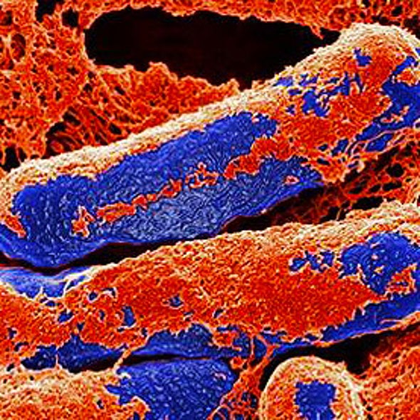 researchers keep mum on botulism discovery scientific american