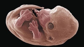 How Mammals Maintain Symmetry during Development