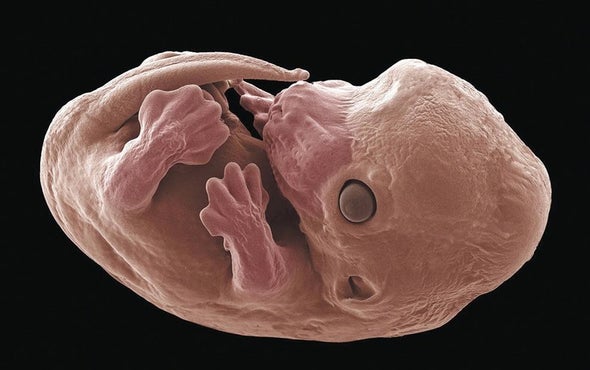 How Mammals Maintain Symmetry during Development