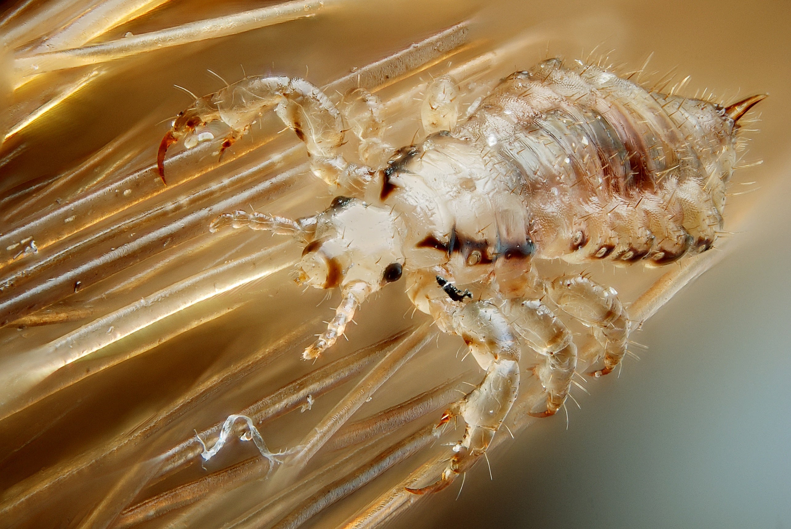 Lice No Longer Stopped by Common Drugstore Remedies - Scientific American