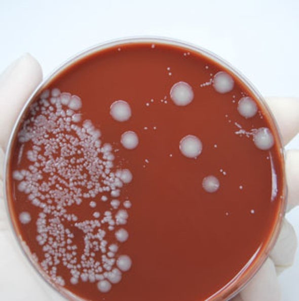 Turning Bacteria into Plastic Factories