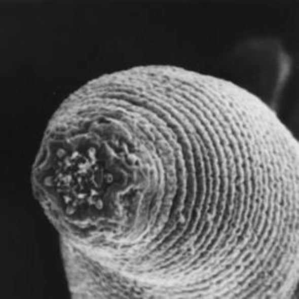 Newly Discovered Microscopic Worm Thrives in Gold Mines a Kilometer Underground