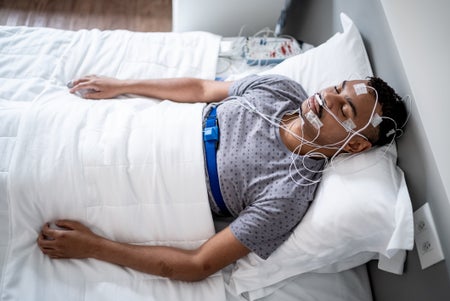 Male patient in hospital bed sleeping with brain wires.