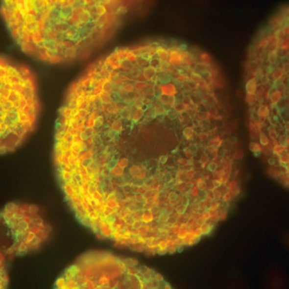 Clumps of Neurons Help Scientists Study Gut Disorders