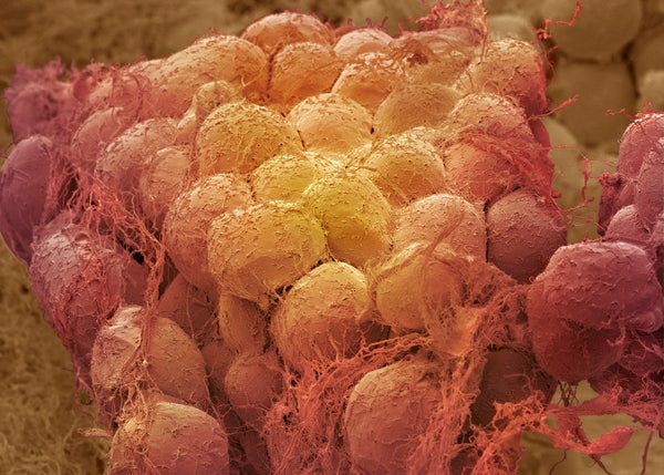 Coloured scanning electron micrograph (SEM) of a sample of fat tissue, showing fat cells (adipocytes, red yellow) surrounded by fine strands of supportive connective tissue.