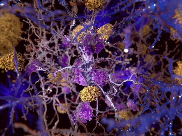 Alzheimer's Study Sparks a New Round of Debate over the Amyloid ...