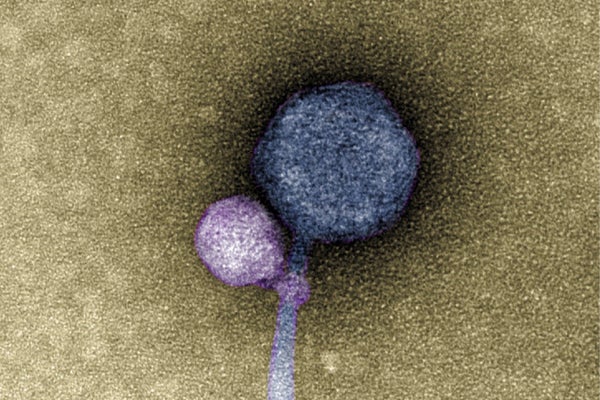 Transmission electron microscope image shows a newly discovered satellite virus latched onto its helper virus.