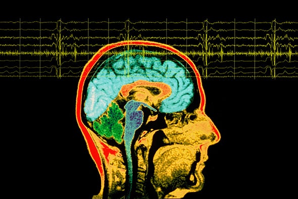 Does Temporal Lobe Epilepsy Influence Personality?
