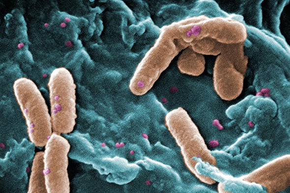 WHO Releases List of World's Most Dangerous Superbugs
