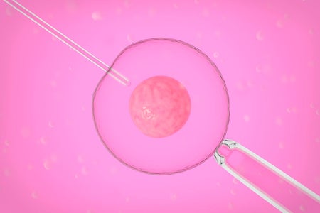 in vitro fertilization