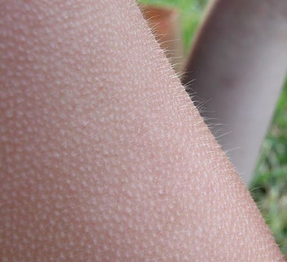 Why do humans get "goosebumps" when they are cold, or under other