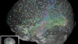 Mapping the Mind: Online Interactive Atlas Shows Activity of 20,000 Brain-Related Genes