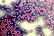 Poliovirus Detected in London Sewage, UK Officials Warn