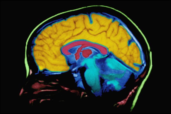 Tech's Brain Effect: It's Complicated