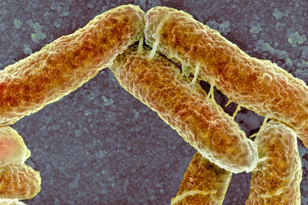 Microscopic view of E-coli.