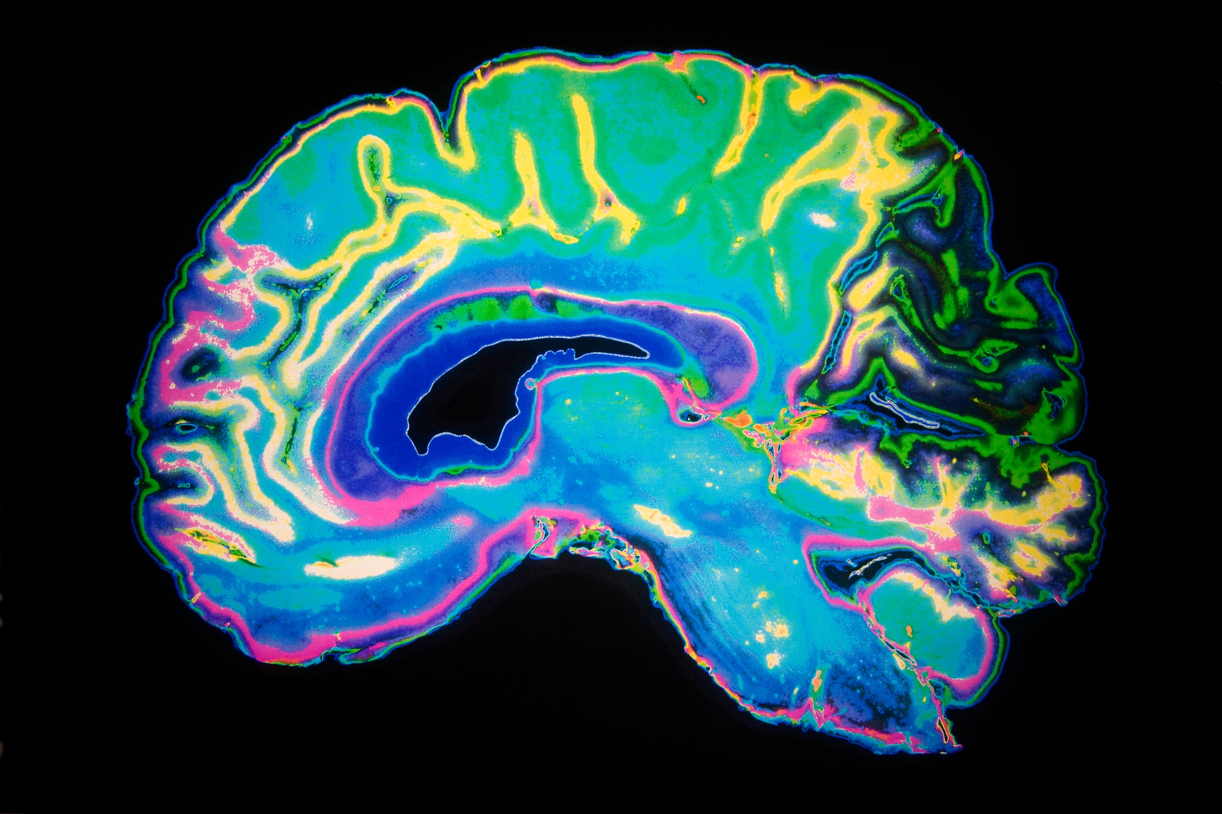 human brain mapping impact factor