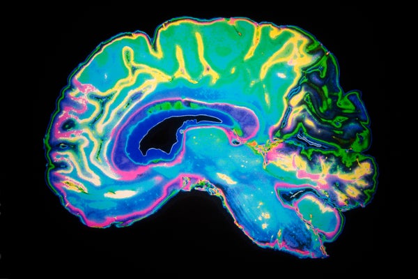 Largest brain map may help scientists study language, diseases : Short Wave  : NPR